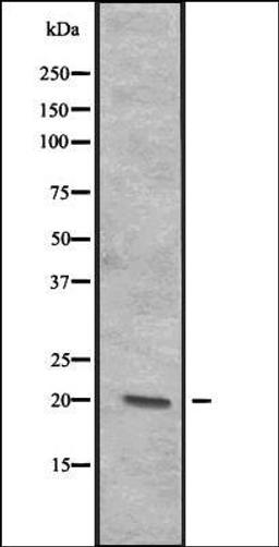 Western blot analysis of A-431 cell lysate at 25ug/lane using CENPR antibody