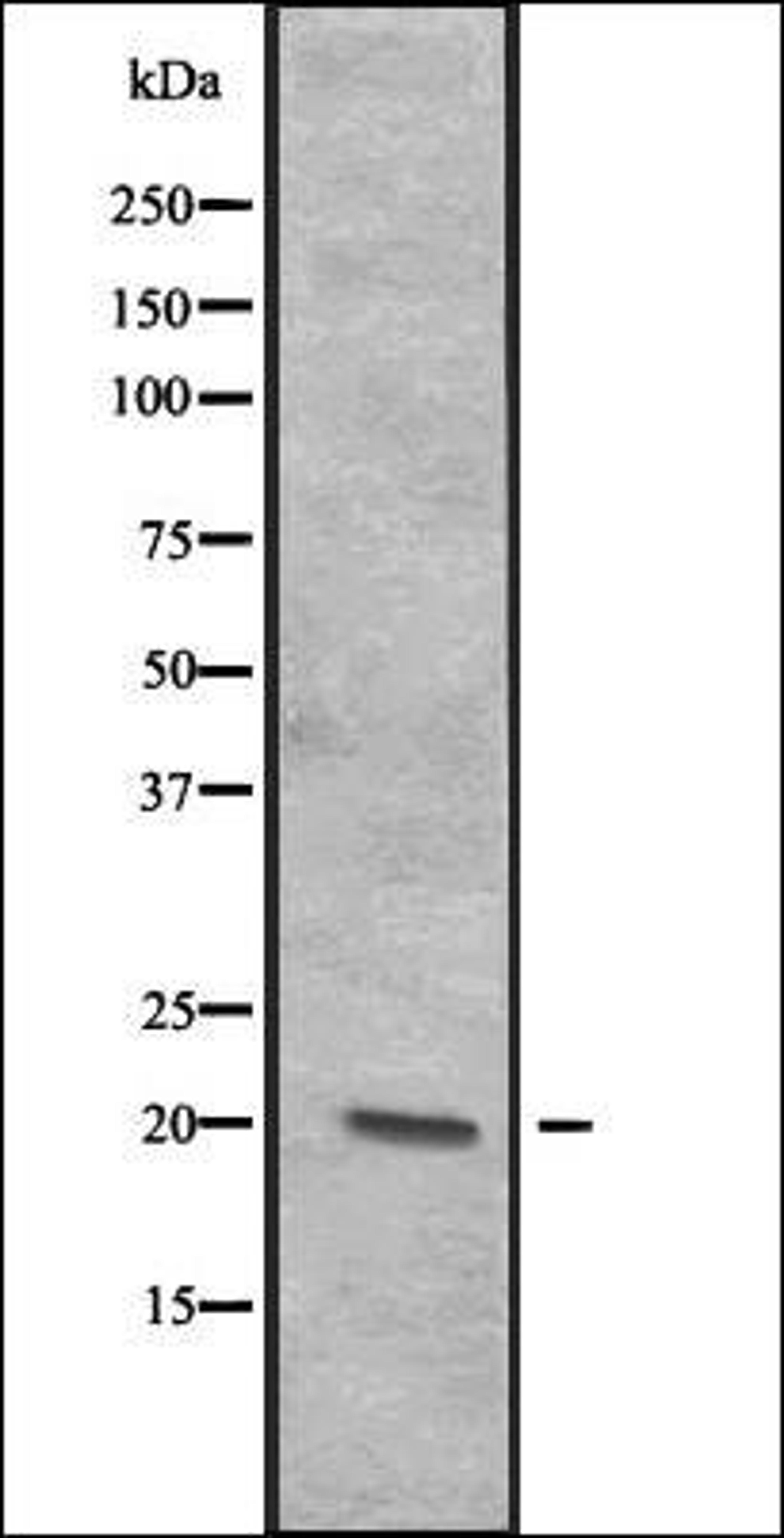 Western blot analysis of A-431 cell lysate at 25ug/lane using CENPR antibody