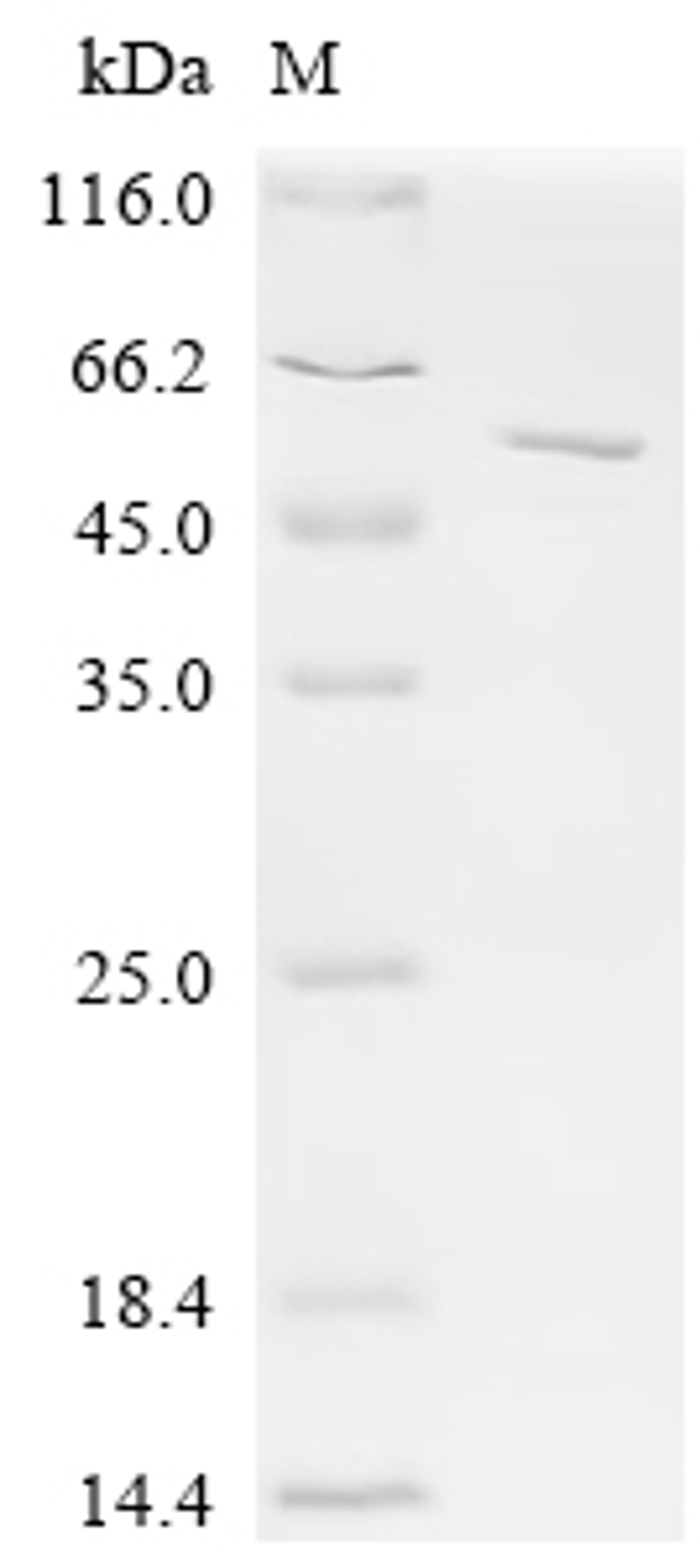 (Tris-Glycine gel) Discontinuous SDS-PAGE (reduced) with 5% enrichment gel and 15% separation gel.