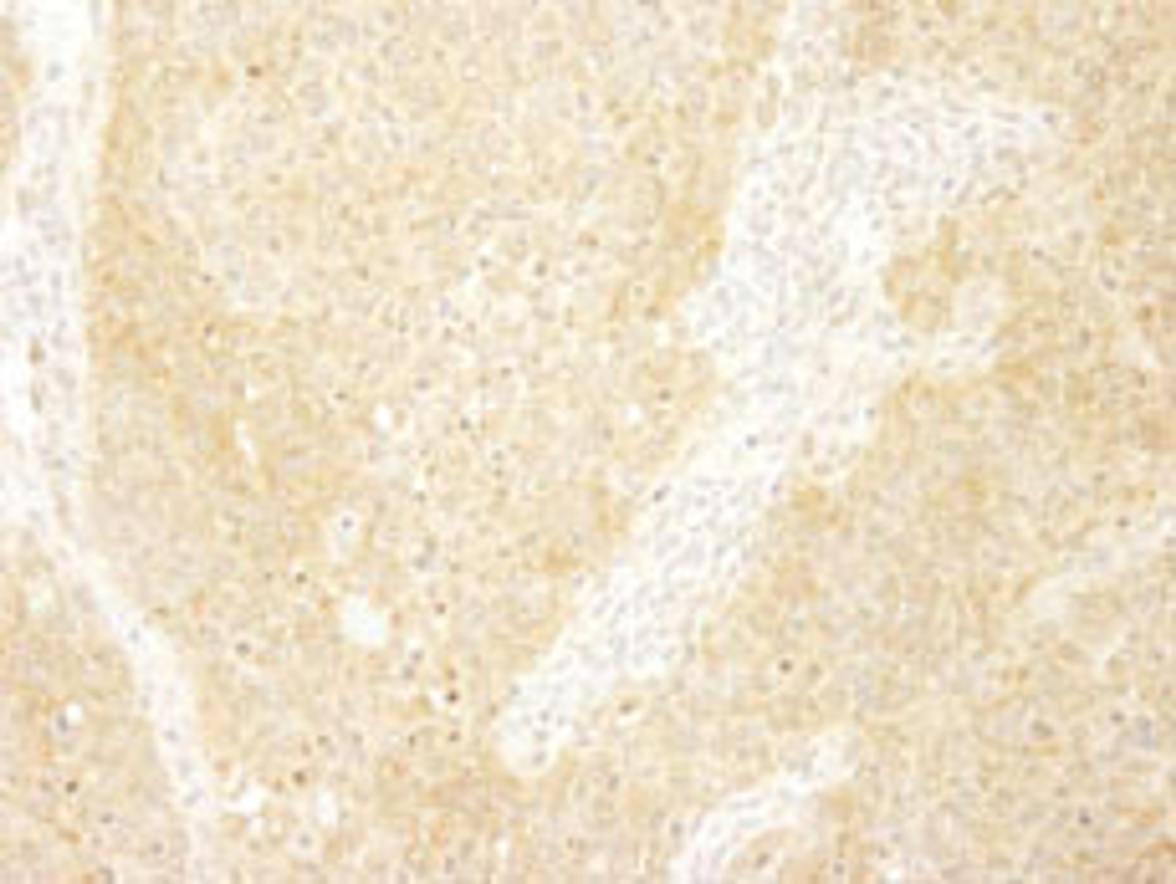 Detection of mouse BCAR1/p130CAS by immunohistochemistry.