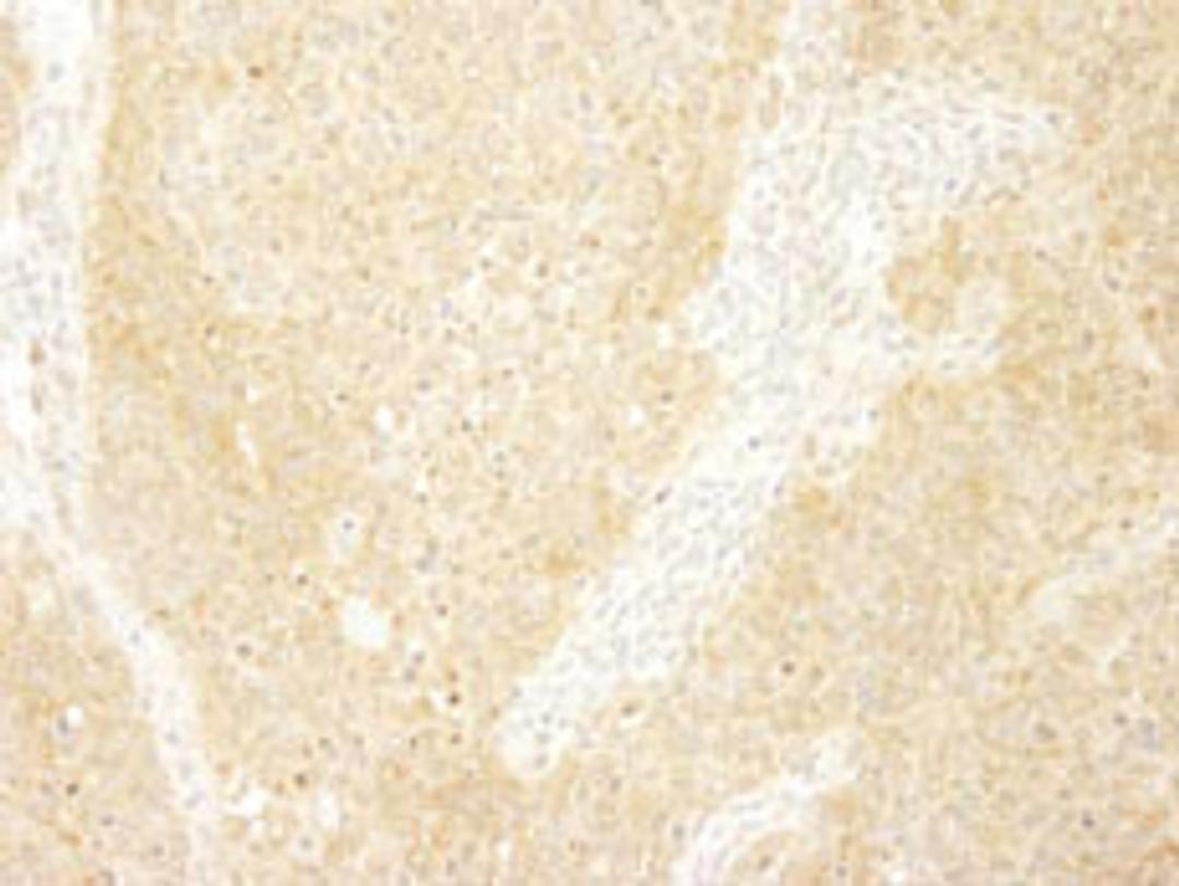 Detection of mouse BCAR1/p130CAS by immunohistochemistry.