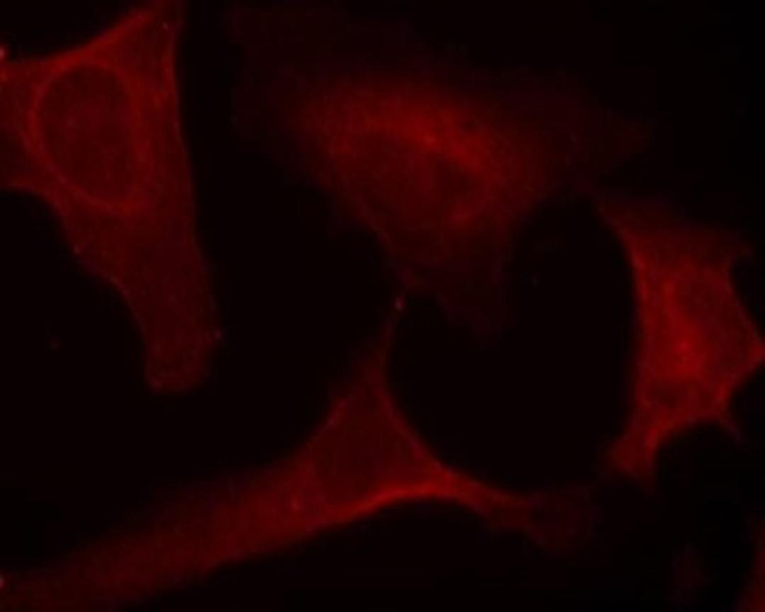 Immunocytochemistry/Immunofluorescence: MEK1 [p Ser221] Antibody [NB100-82033] - Staining of methanol-fixed Hela cells using MEK1(Phospho-Ser221) antibody