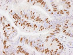 Detection of human USP7 by immunohistochemistry.