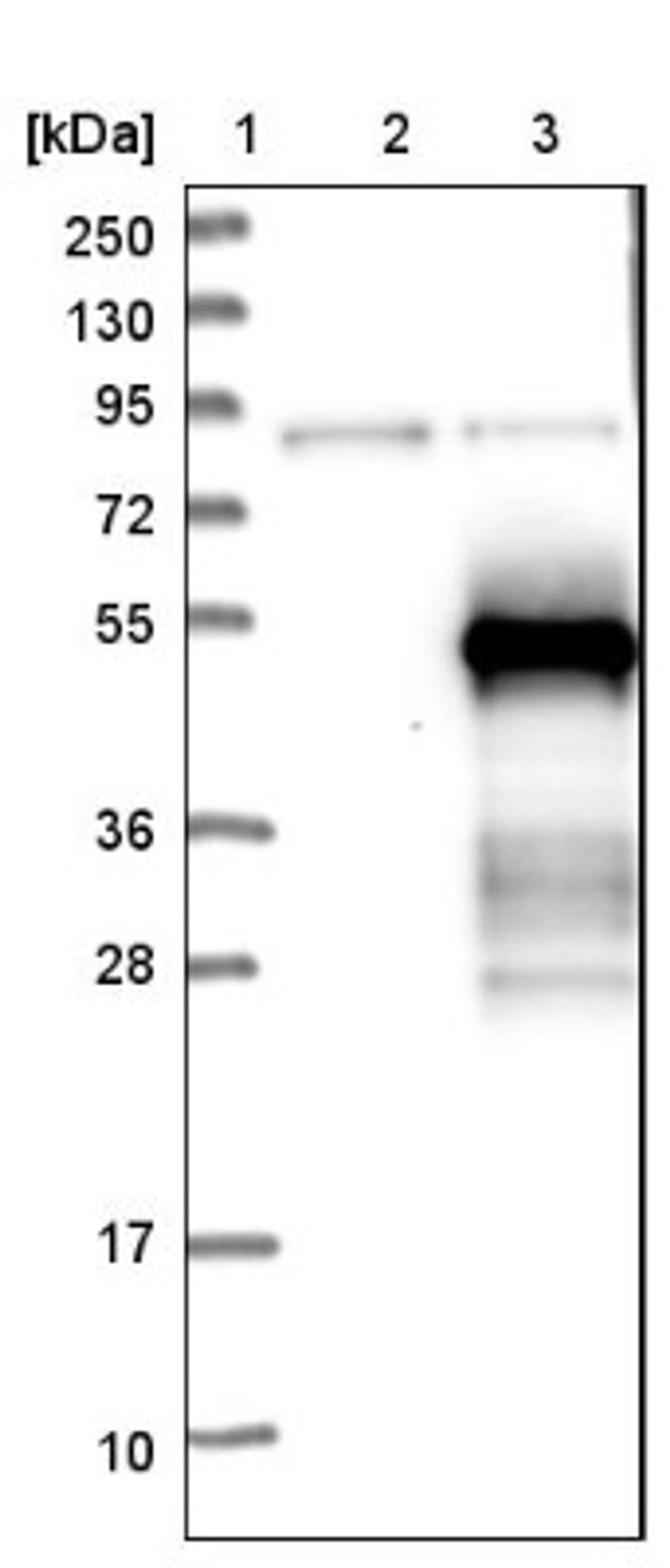 Western Blot: ZNF174 Antibody [NBP1-86821] - Lane 1: Marker [kDa] 250, 130, 95, 72, 55, 36, 28, 17, 10<br/>Lane 2: Negative control (vector only transfected HEK293T lysate)<br/>Lane 3: Over-expression lysate (Co-expressed with a C-terminal myc-DDK tag (~3.1 kDa) in mammalian HEK293T cells, LY418676)