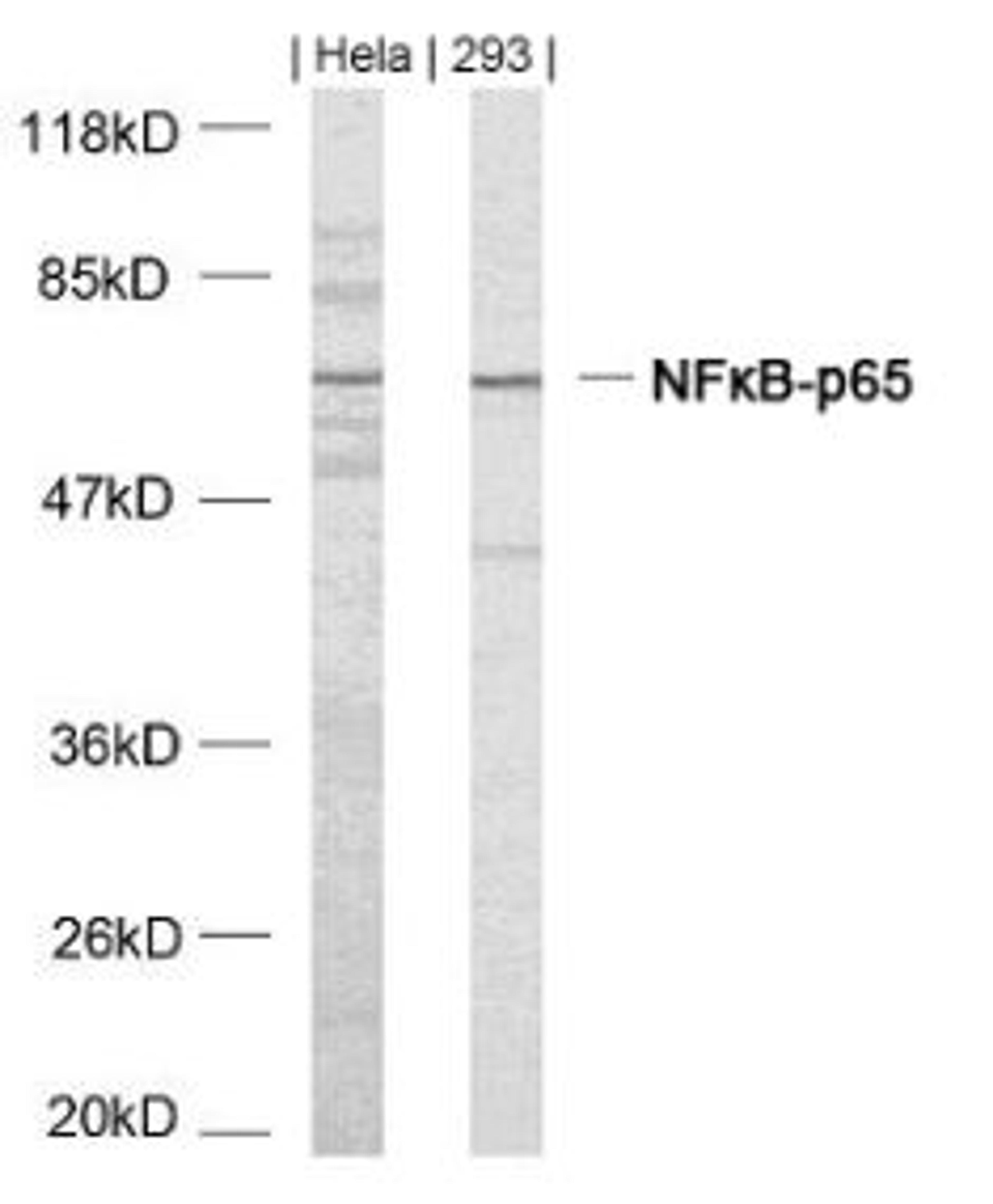Western blot analysis of lysed extracts from HeLa and 293 cells using NFκB-p65 (Ab-468).