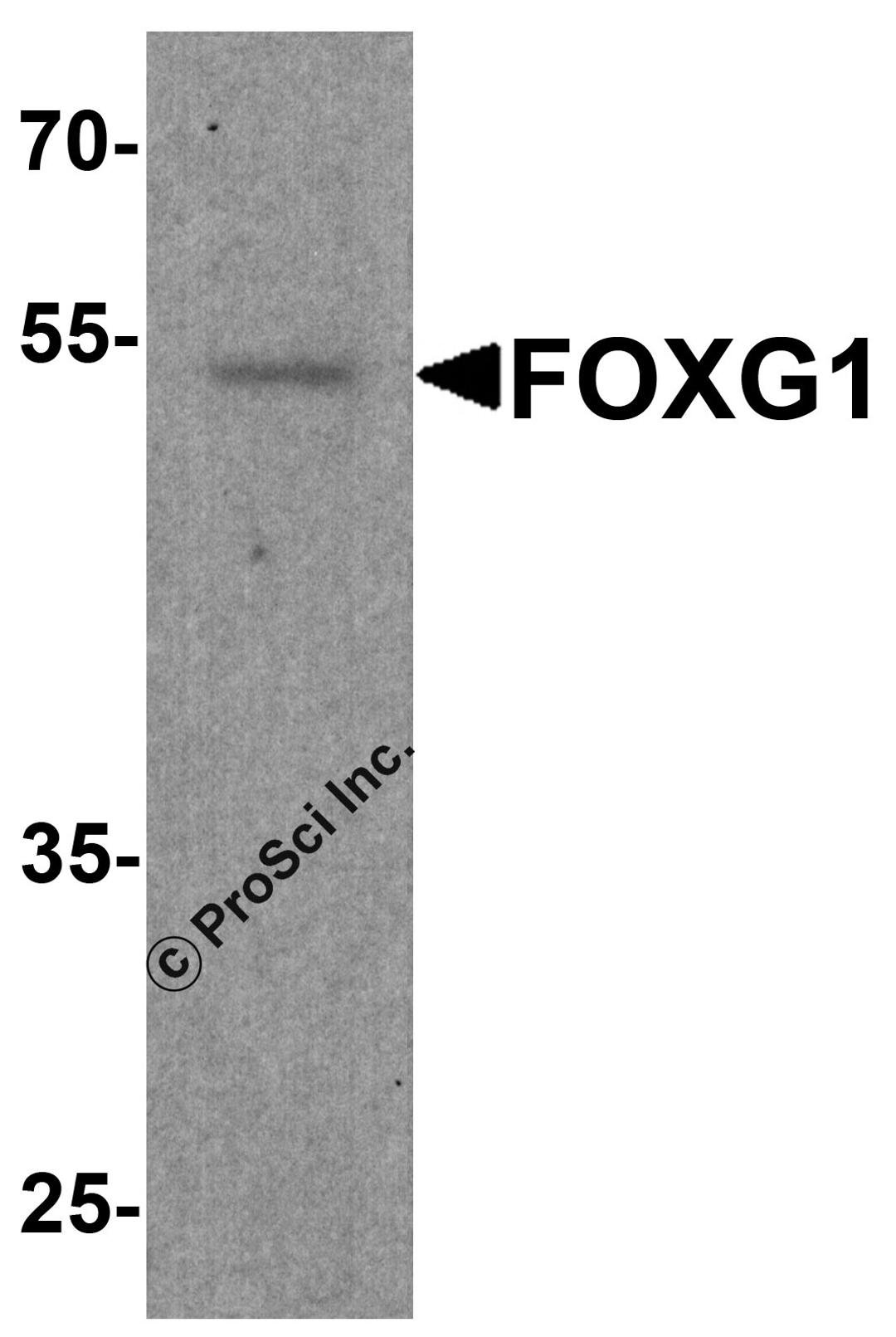 Western blot analysis of FOXG1 in rat brain tissue lysate with FOXG1 antibody at 1 μg/ml.