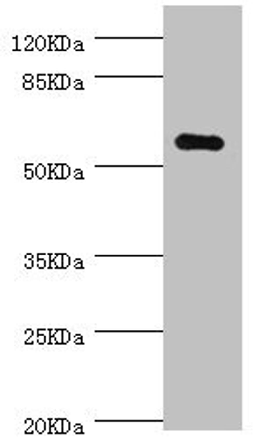 Western blot. All lanes: NLK antibody at 0.7ug/ml + MCF-7 whole cell lysate. Secondary. Goat polyclonal to rabbit IgG at 1/10000 dilution. Predicted band size: 58 kDa. Observed band size: 58 kDa.
