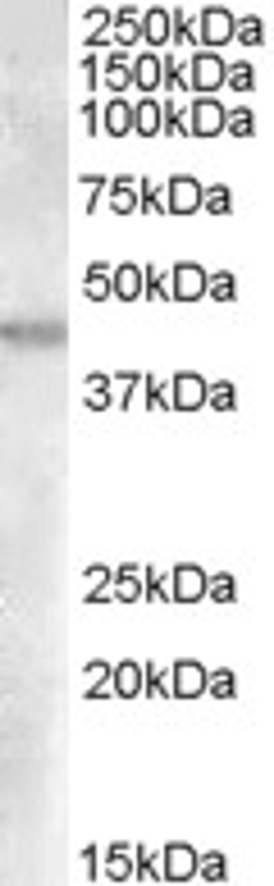 45-691 (0.03ug/ml) staining of Human Kidney lysate (35ug protein in RIPA buffer). Primary incubation was 1 hour. Detected by chemiluminescence.