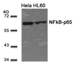 Western blot analysis of lysed extracts from HeLa and HL60 cells using NFκB-p65 (Ab-311).