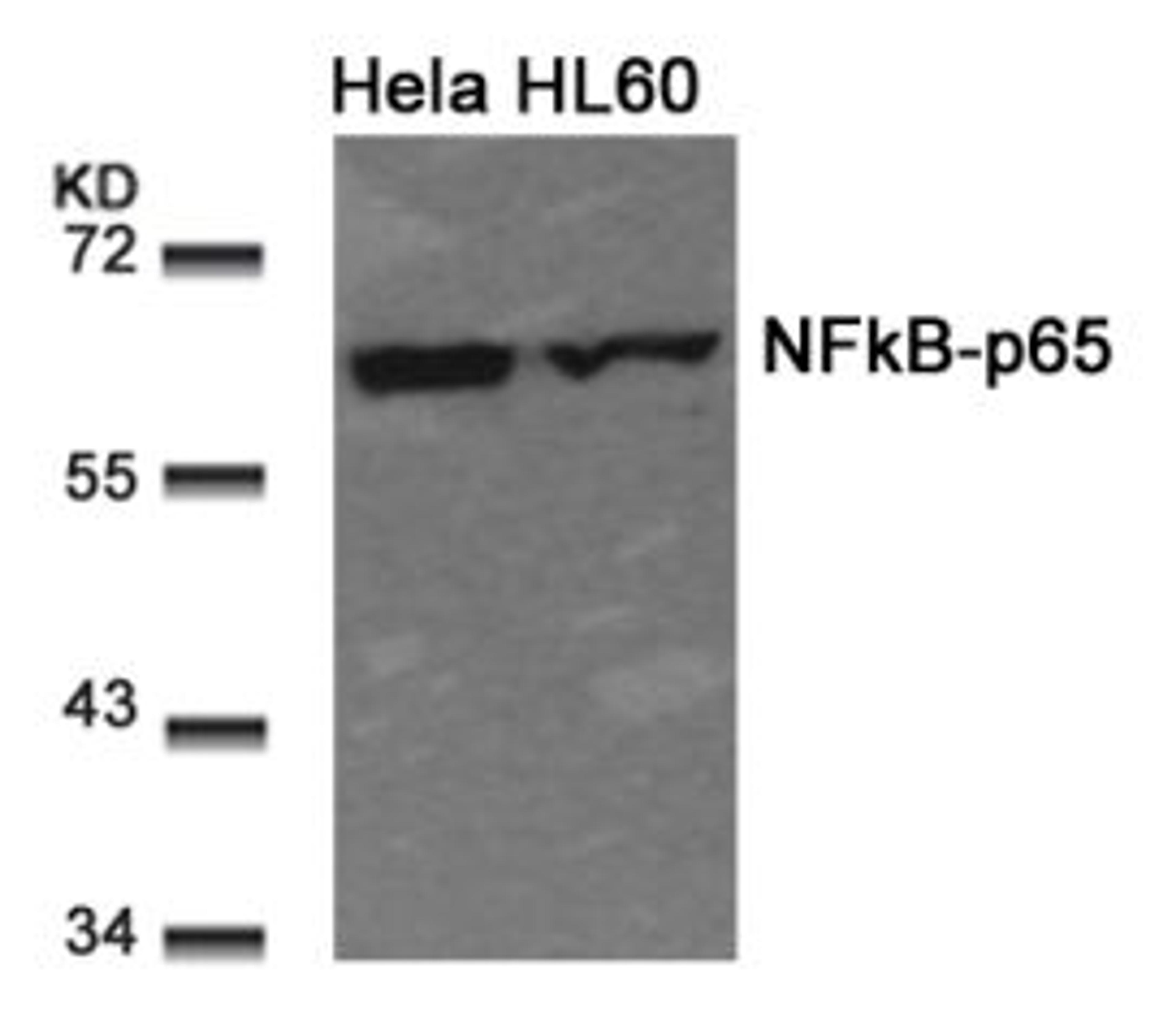 Western blot analysis of lysed extracts from HeLa and HL60 cells using NFκB-p65 (Ab-311).