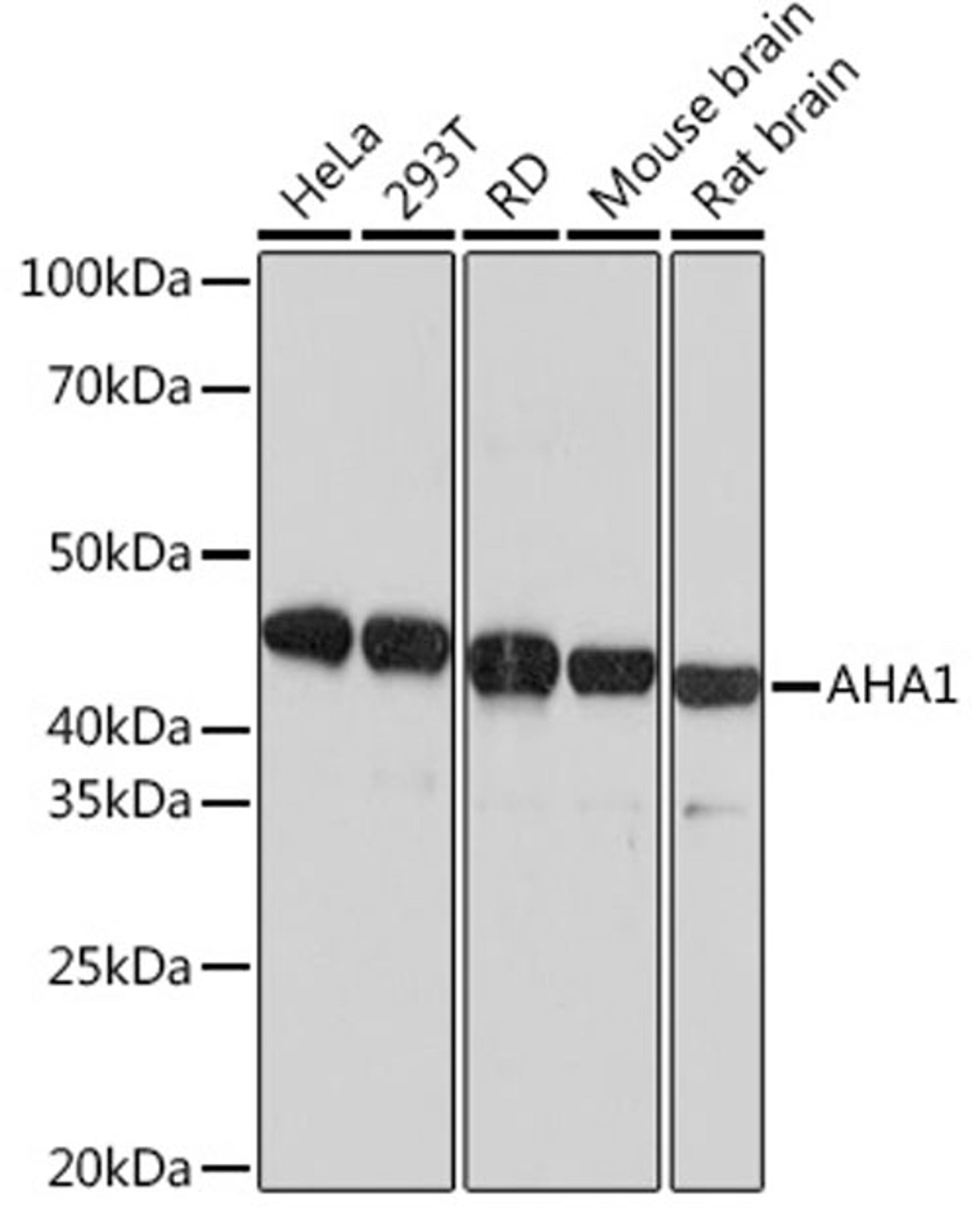 Western blot - AHA1 Rabbit mAb (A9538)