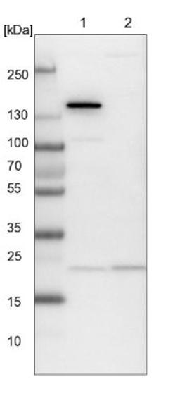 Western Blot: ARL3 Antibody [NBP1-88839] - Lane 1: NIH-3T3 cell lysate (Mouse embryonic fibroblast cells)<br/>Lane 2: NBT-II cell lysate (Rat Wistar bladder tumour cells)