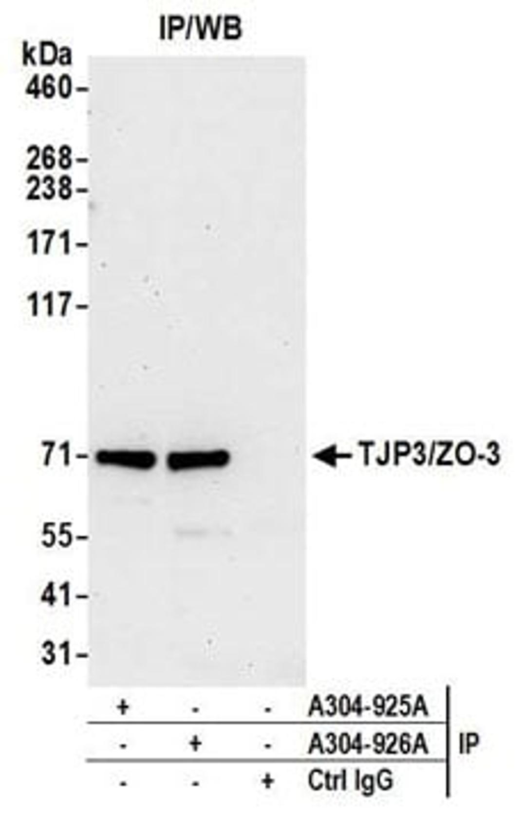 Detection of human TJP3/ZO-3 by western blot of immunoprecipitates.