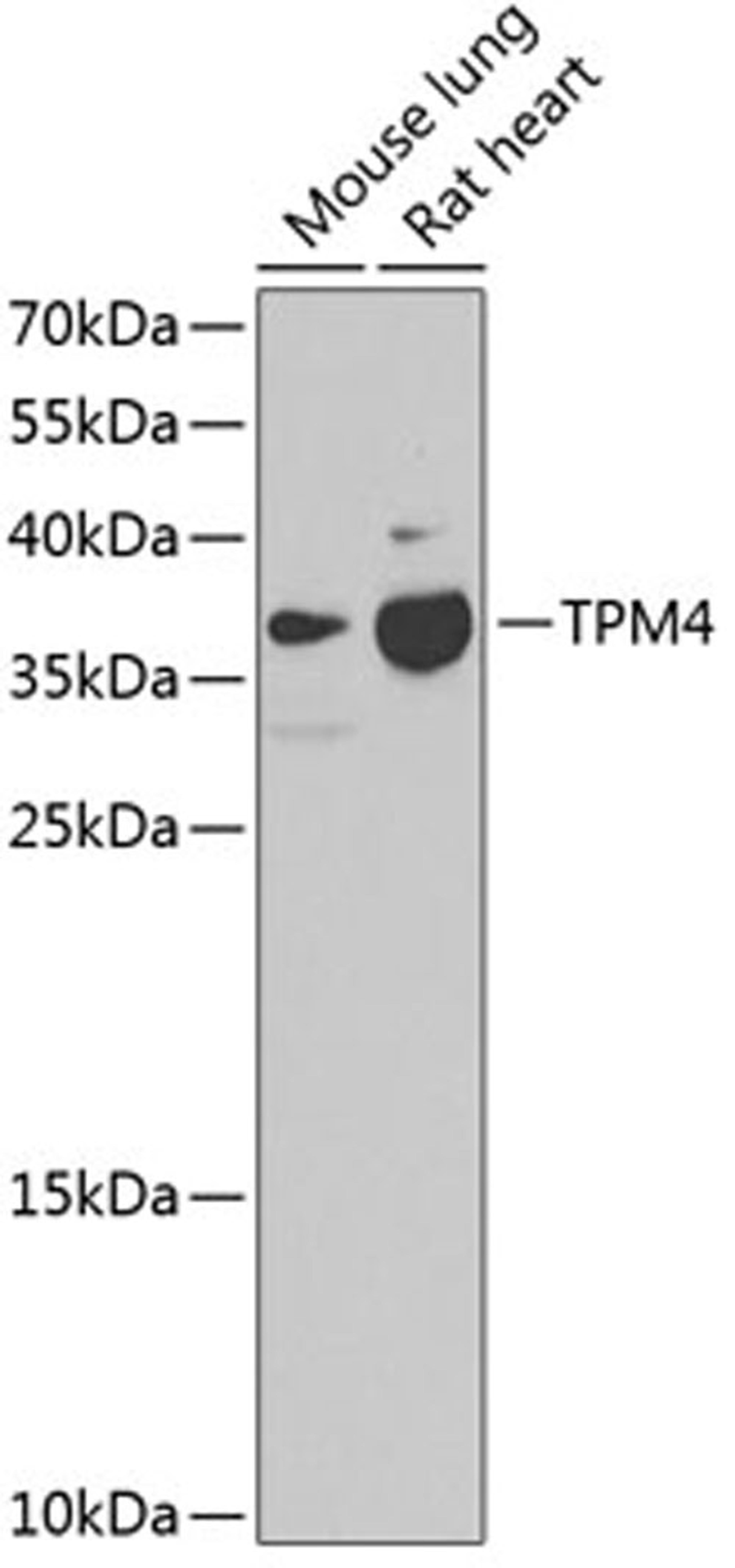 Western blot - TPM4 antibody (A4166)