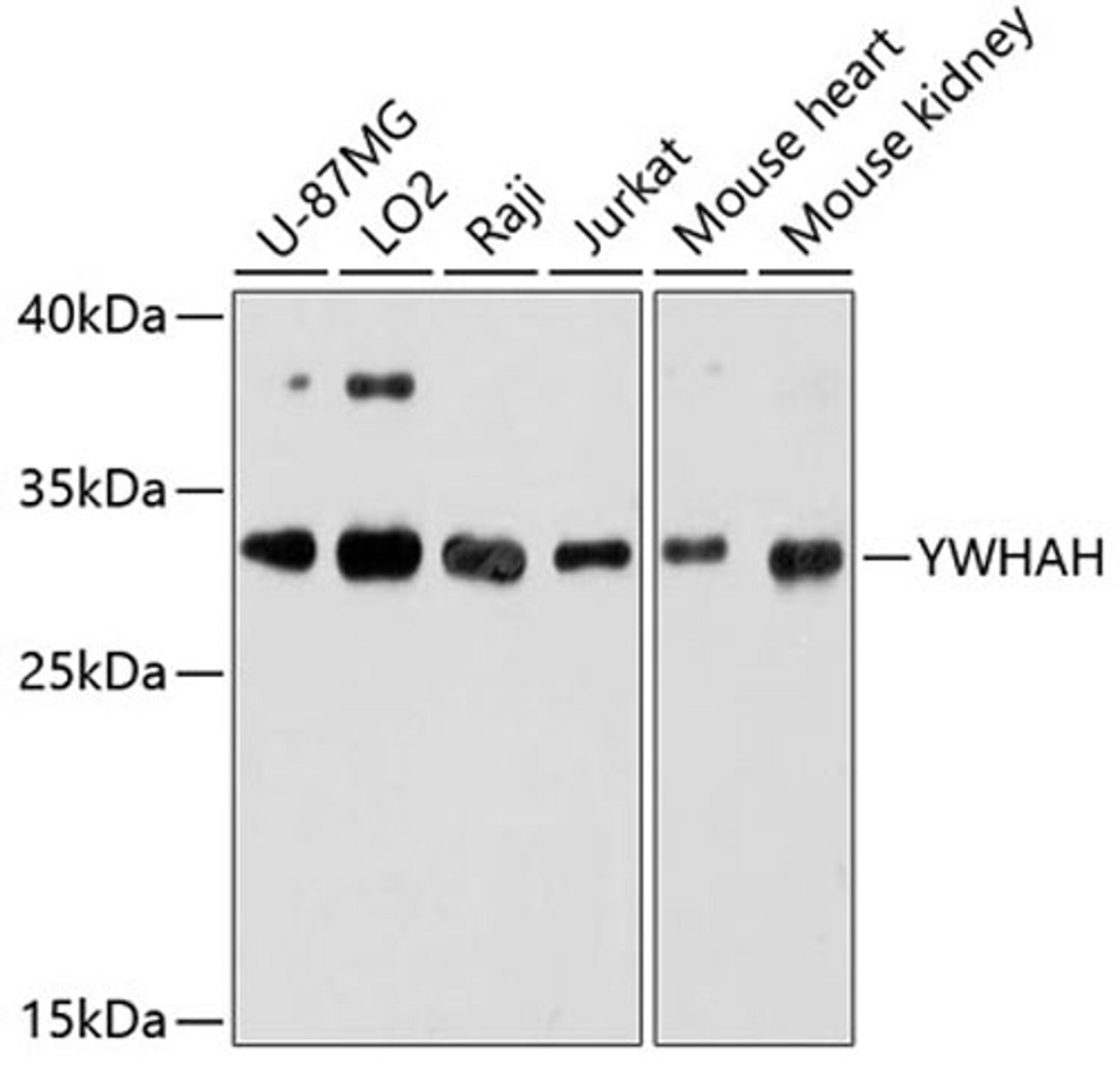 Western blot - YWHAH antibody (A9079)