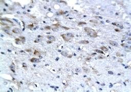 Immunohistochemical staining of paraffin embedded rat brain tissue using NSE antibody