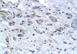 Immunohistochemical staining of paraffin embedded rat brain tissue using NSE antibody