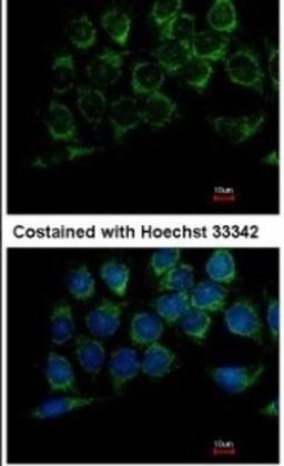 Immunocytochemistry: Dihydrolipoamide Dehydrogenase/DLD Antibody [NBP1-31302] - Analysis of methanol-fixed Hep3B, using antibody at 1:100 dilution.