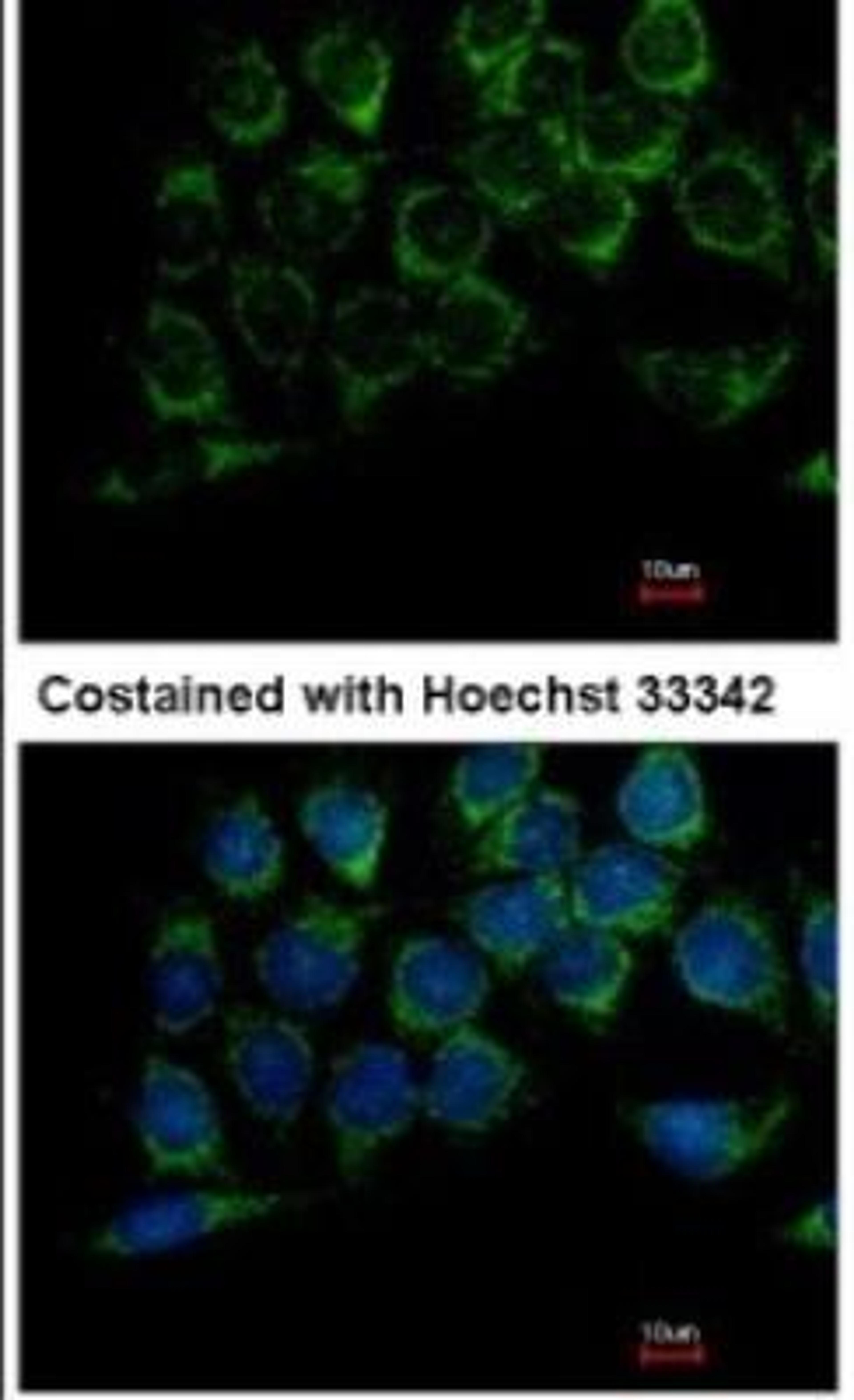 Immunocytochemistry: Dihydrolipoamide Dehydrogenase/DLD Antibody [NBP1-31302] - Analysis of methanol-fixed Hep3B, using antibody at 1:100 dilution.