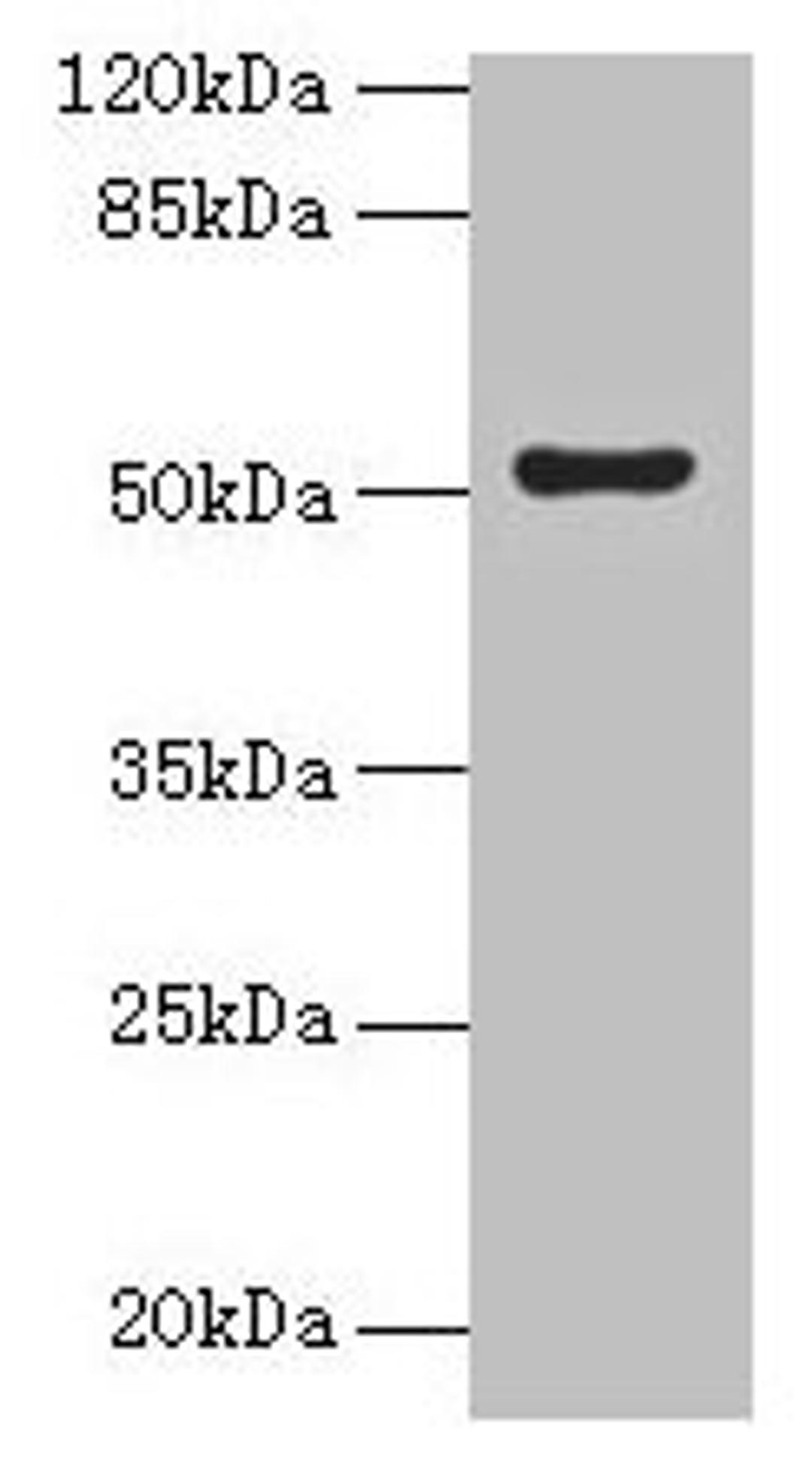 Western blot. All lanes: SLC46A3 antibody at 4µg/ml + Jurkat whole cell lysate. Secondary. Goat polyclonal to rabbit IgG at 1/10000 dilution. Predicted band size: 52, 43 kDa. Observed band size: 52 kDa