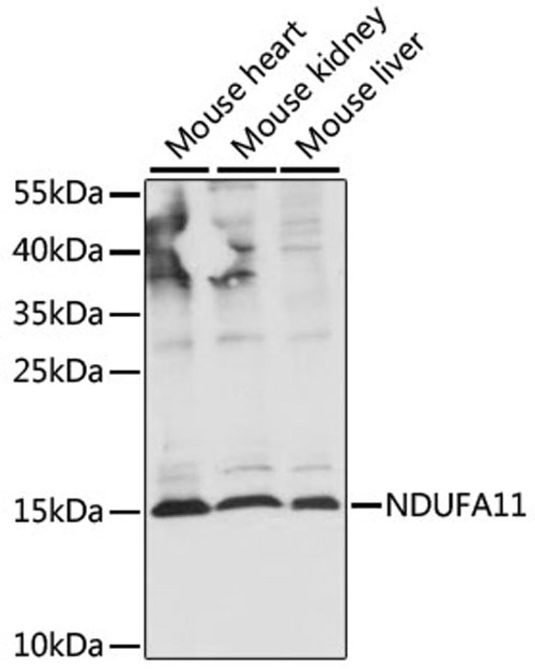 Western blot - NDUFA11 antibody (A16239)