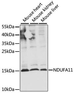 Western blot - NDUFA11 antibody (A16239)