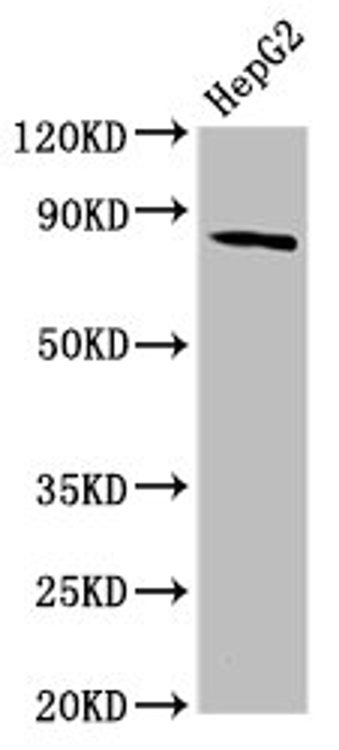 Western Blot. Positive WB detected in: HepG2 whole cell lysate. All lanes: MTSS1 antibody at 3.84ug/ml. Secondary. Goat polyclonal to rabbit IgG at 1/50000 dilution. Predicted band size: 83, 51, 80 kDa. Observed band size: 83 kDa.
