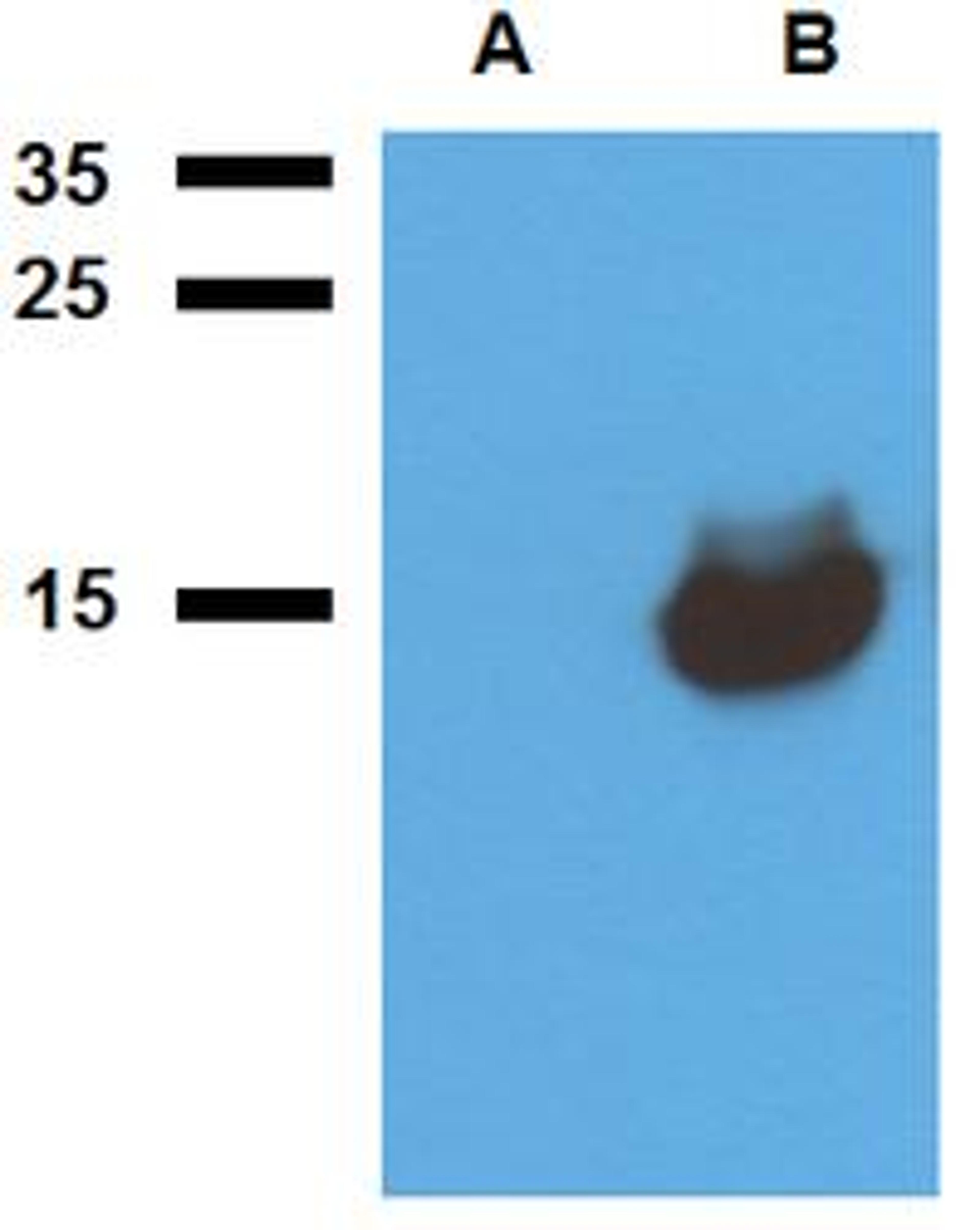 WB analysis of cell lysate of non-transfected E. coli (Lane1), cell lysate of Acr1-transfected E. coli (Lane2) using Acr1 antibody