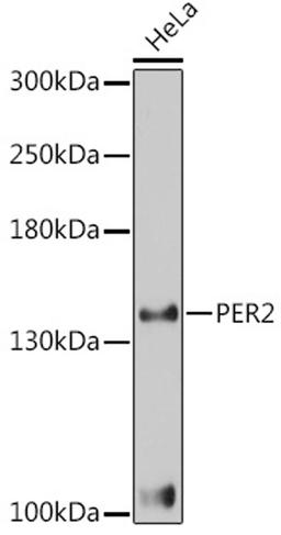 Western blot - PER2 antibody (A3217)