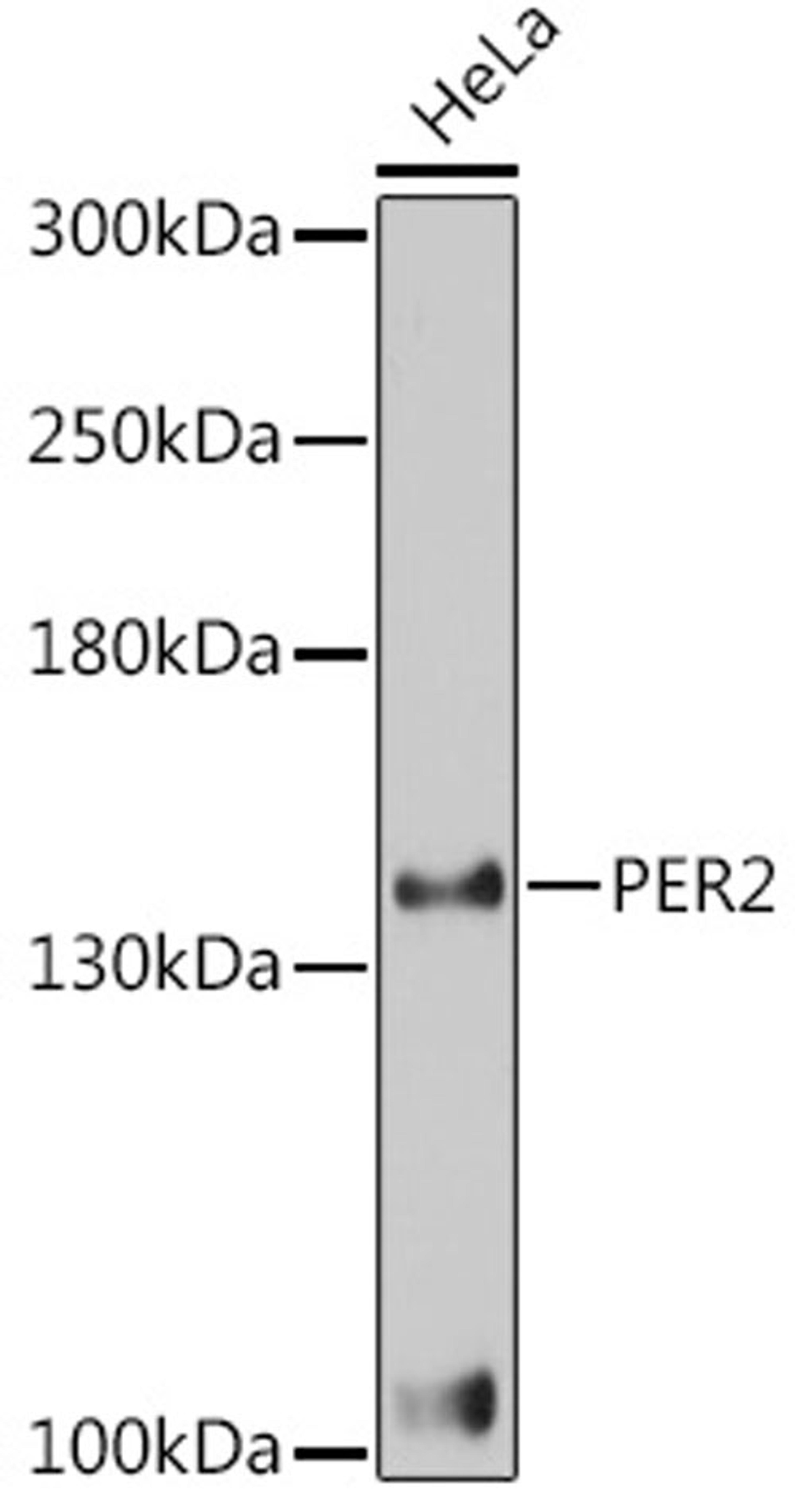Western blot - PER2 antibody (A3217)