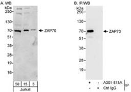 Detection of human ZAP70 by western blot and immunoprecipitation.