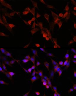 Immunofluorescence - UBIAD1 antibody (A14214)