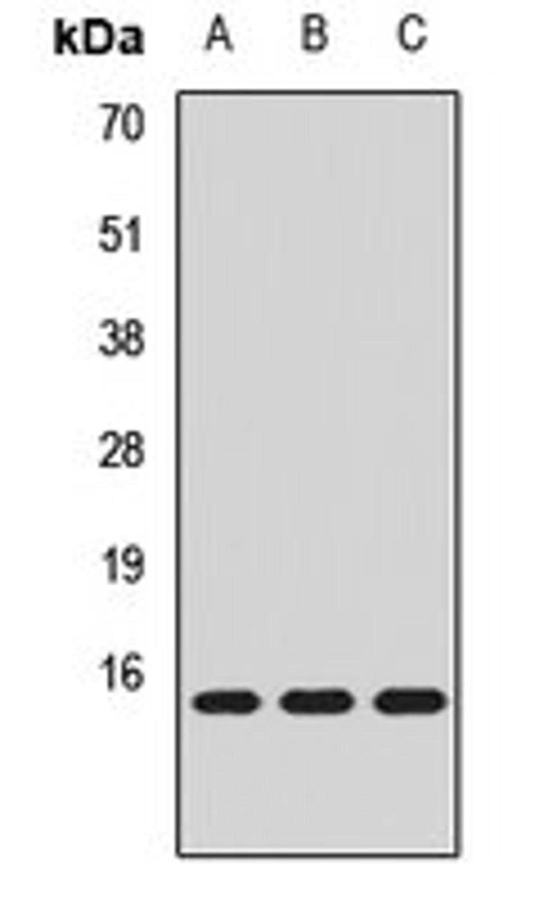 Western blot analysis of A431 (Lane1), SKOV3 (Lane2), MCF7 (Lane3) whole cell lysates using MRFAP1 antibody