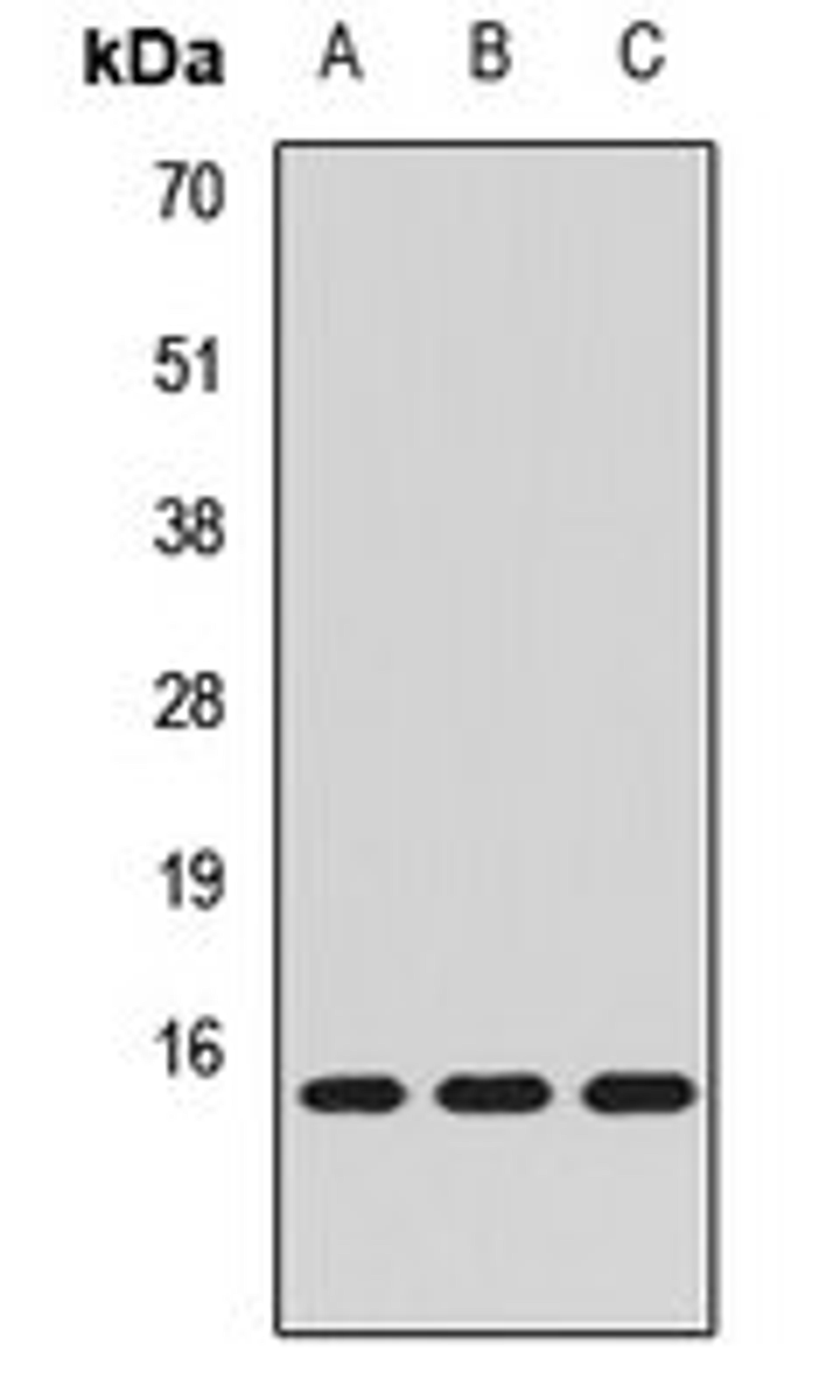 Western blot analysis of A431 (Lane1), SKOV3 (Lane2), MCF7 (Lane3) whole cell lysates using MRFAP1 antibody