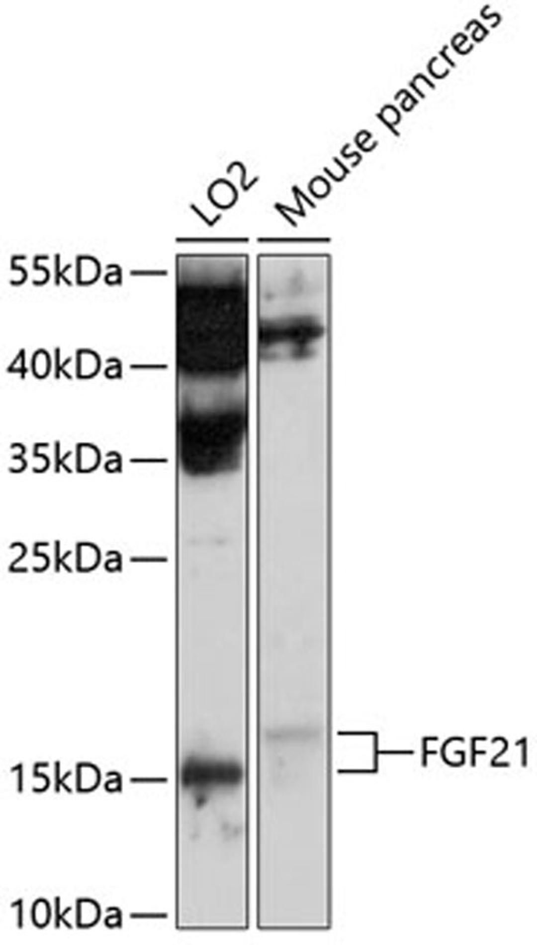 Western blot - FGF21 antibody (A10368)