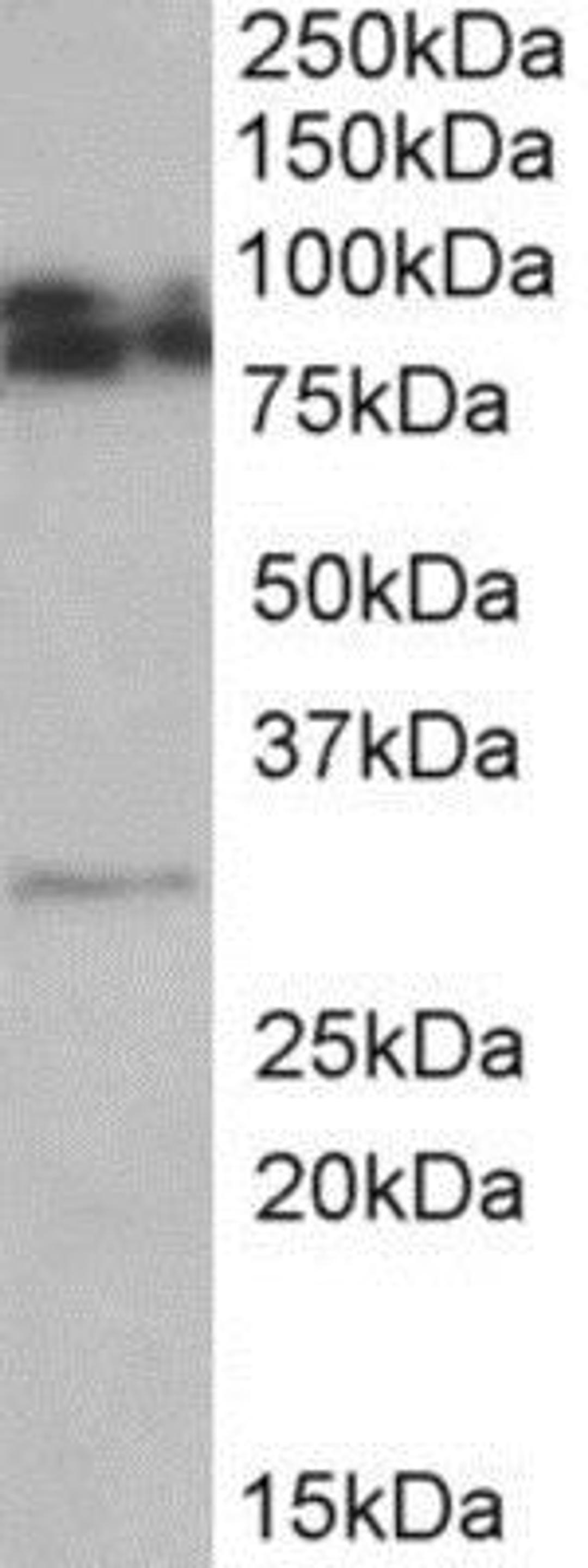 Western Blot: GPM6A Antibody [NBP1-68861] - NBP1-68861 (0.5ug/ml) staining of Rat Brain lysate (35ug protein in RIPA buffer). Primary incubation was 1 hour. Detected by chemiluminescence.