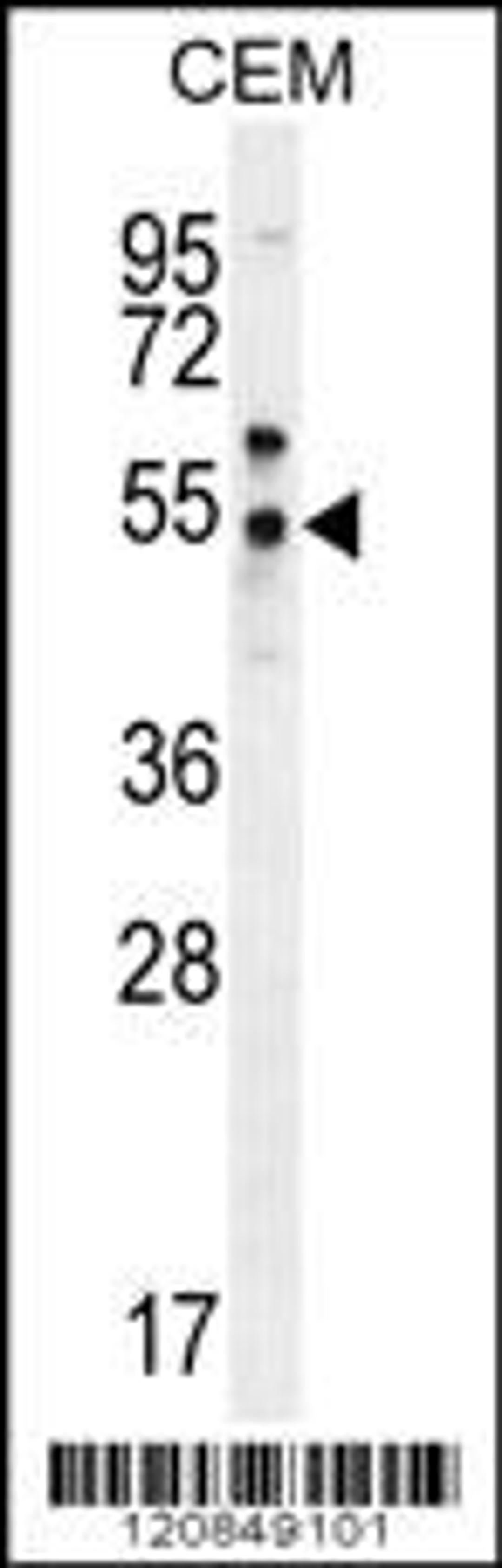 Western blot analysis in CEM cell line lysates (35ug/lane).