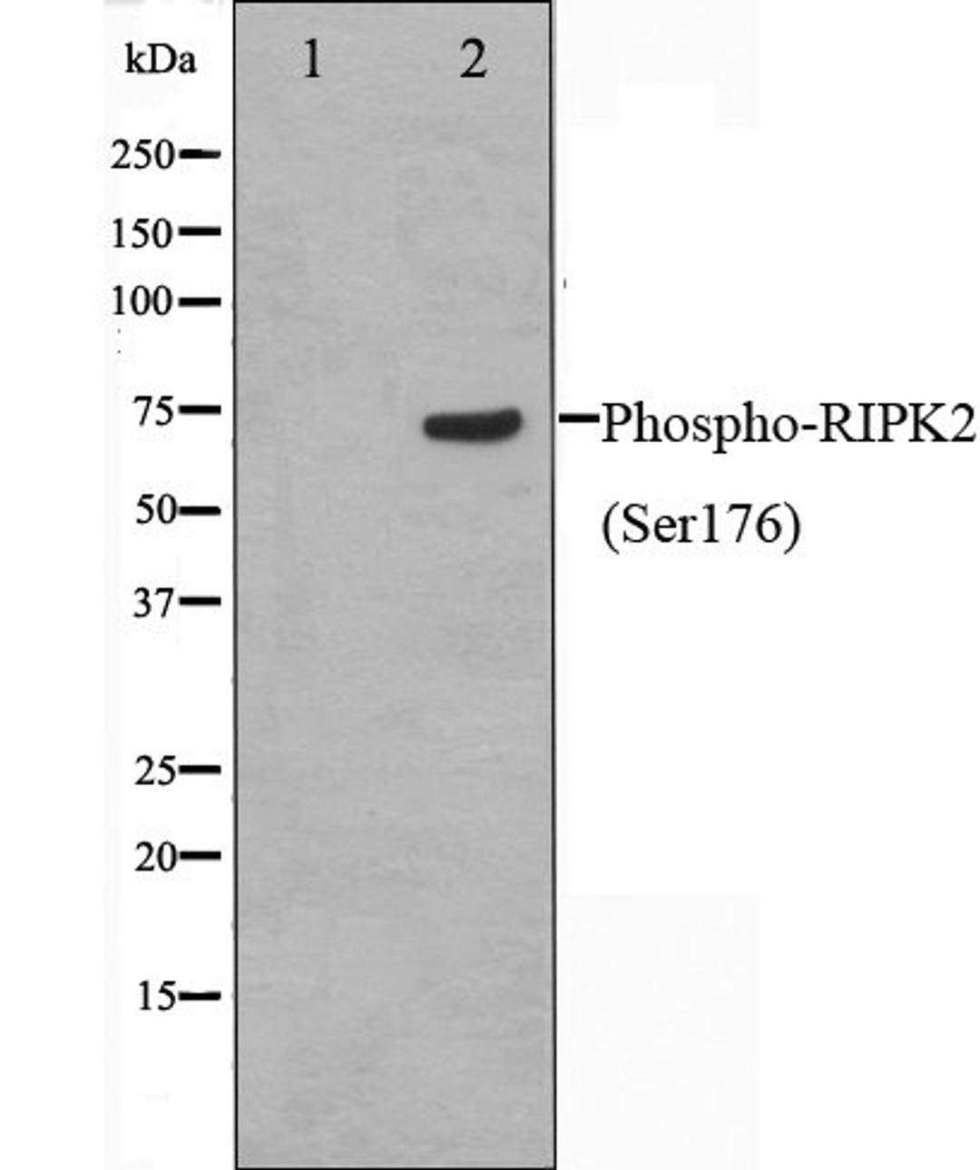 Western blot analysis of 293 cell lysate using RIPK2 (Phospho-Ser176) antibody