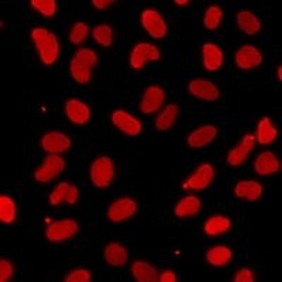 Immunofluorescent analysis of A549 cells using IWS1 antibody