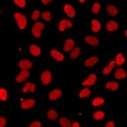 Immunofluorescent analysis of A549 cells using IWS1 antibody