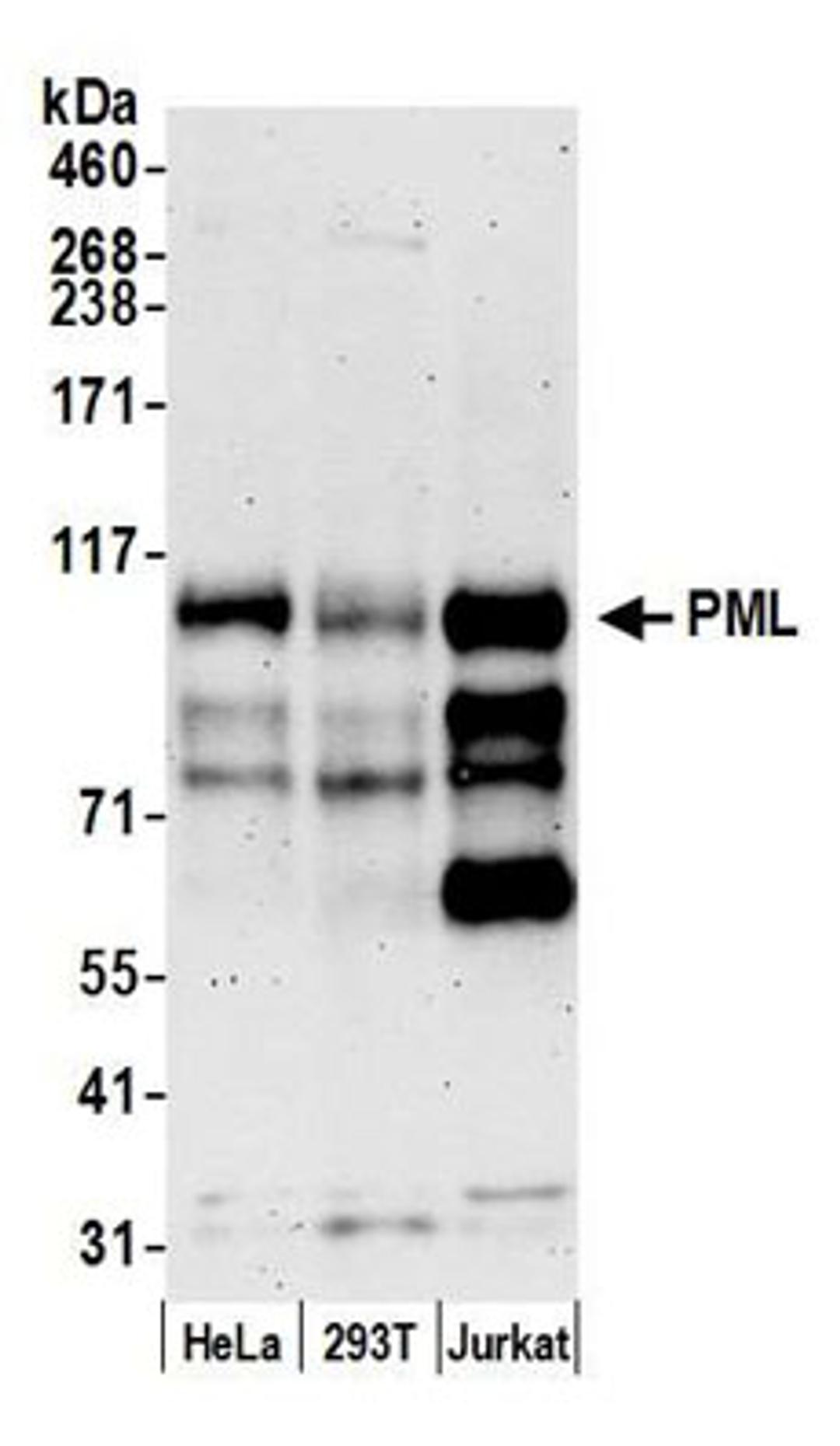 Detection of human PML by western blot.