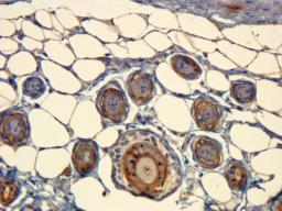 Immunohistochemical staining of paraffin embedded mouse skin tissue using CD63 antibody (primary antibody at 1:100)