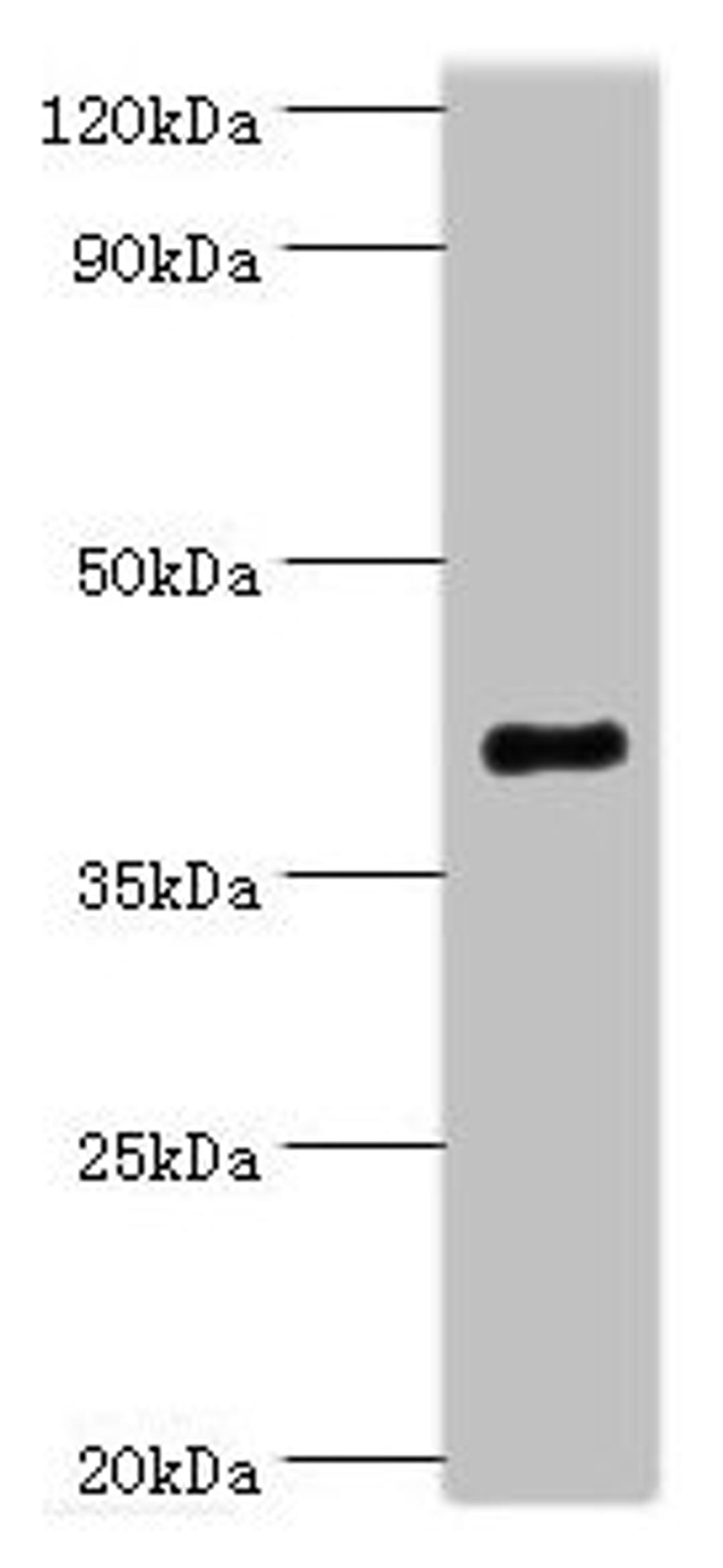 Western blot. All lanes: Endophilin-B1 antibody at 2ug/ml + Mouse kidney tissue. Secondary. Goat polyclonal to rabbit IgG at 1/10000 dilution. Predicted band size: 41, 44, 30 kDa. Observed band size: 41 kDa. 