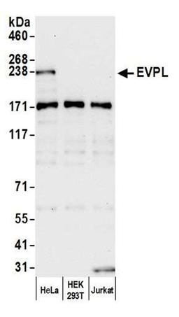 Detection of human EVPL by WB.