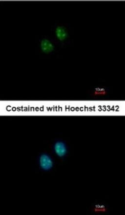 Immunocytochemistry/Immunofluorescence: NAT10 Antibody [NBP2-15034] - Paraformaldehyde-fixed MCF-7, using antibody at 1:200 dilution.