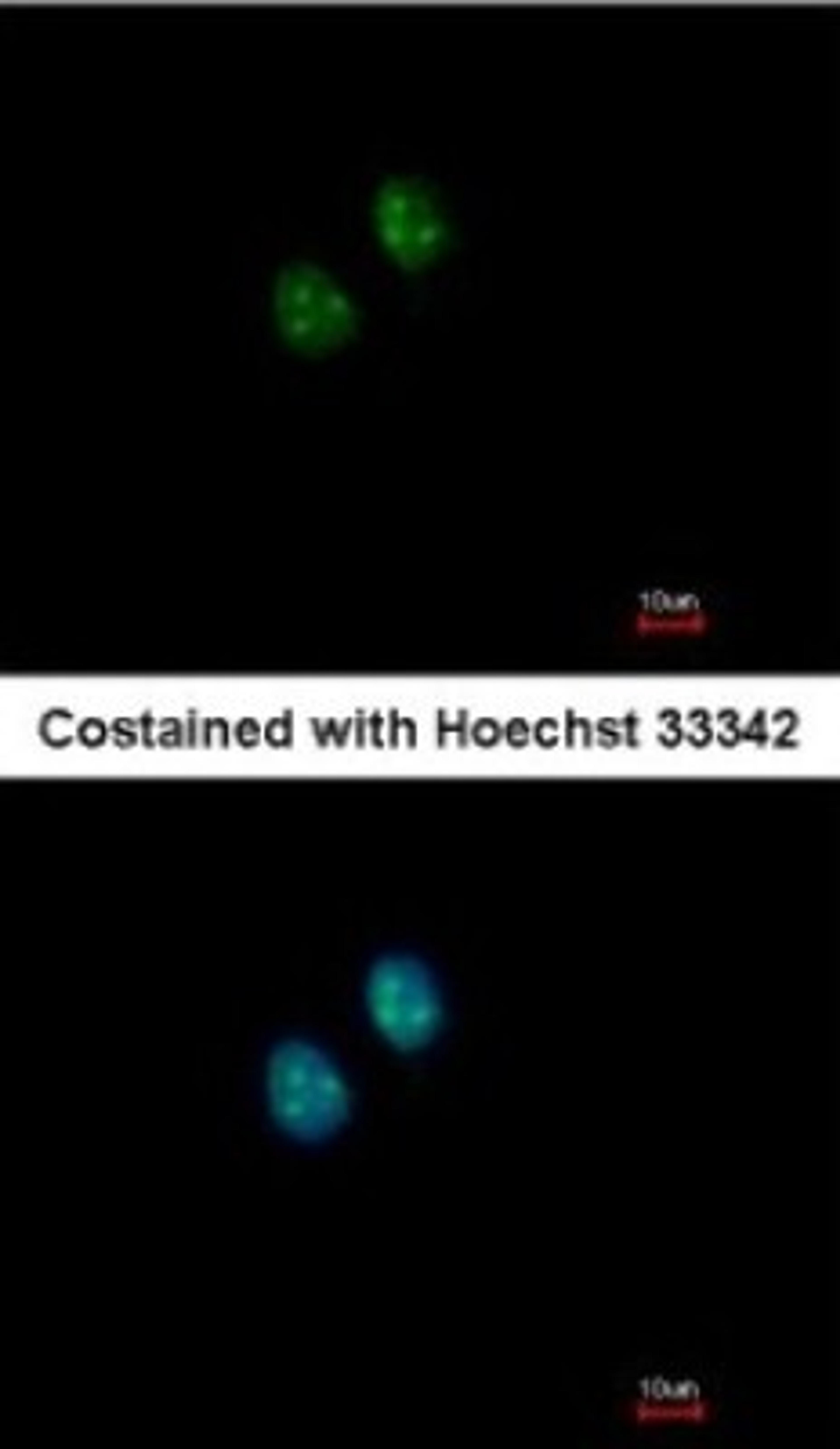 Immunocytochemistry/Immunofluorescence: NAT10 Antibody [NBP2-15034] - Paraformaldehyde-fixed MCF-7, using antibody at 1:200 dilution.