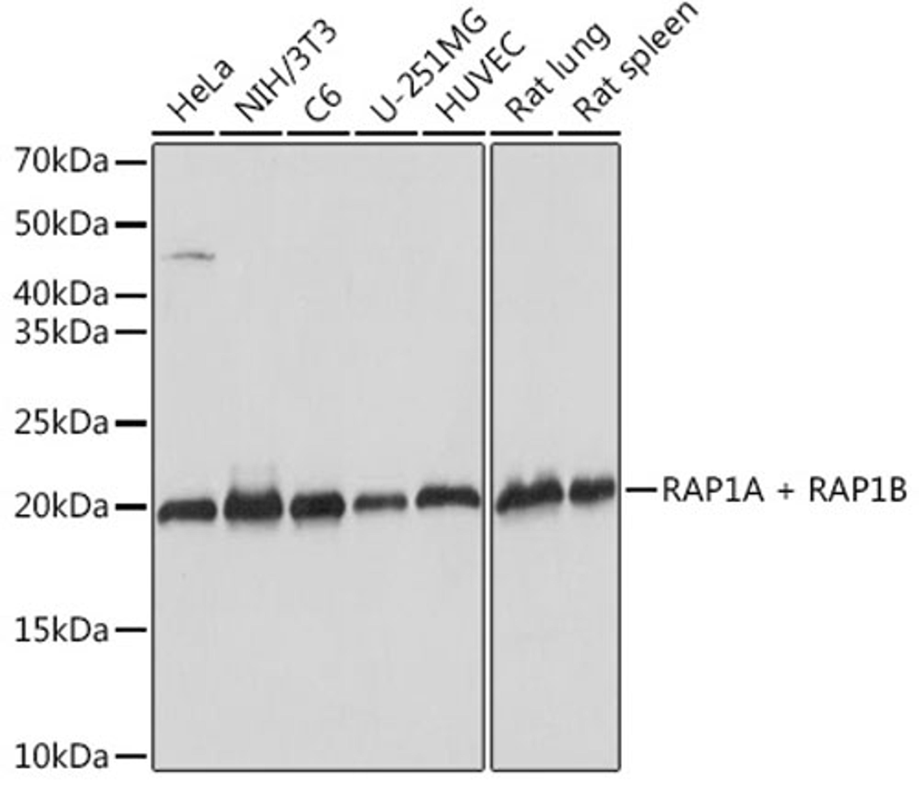 Western blot - RAP1A + RAP1B Rabbit mAb (A9725)