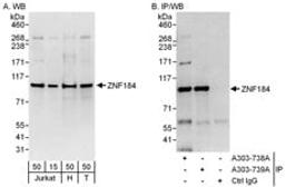 Detection of human ZNF184 by western blot and immunoprecipitation.