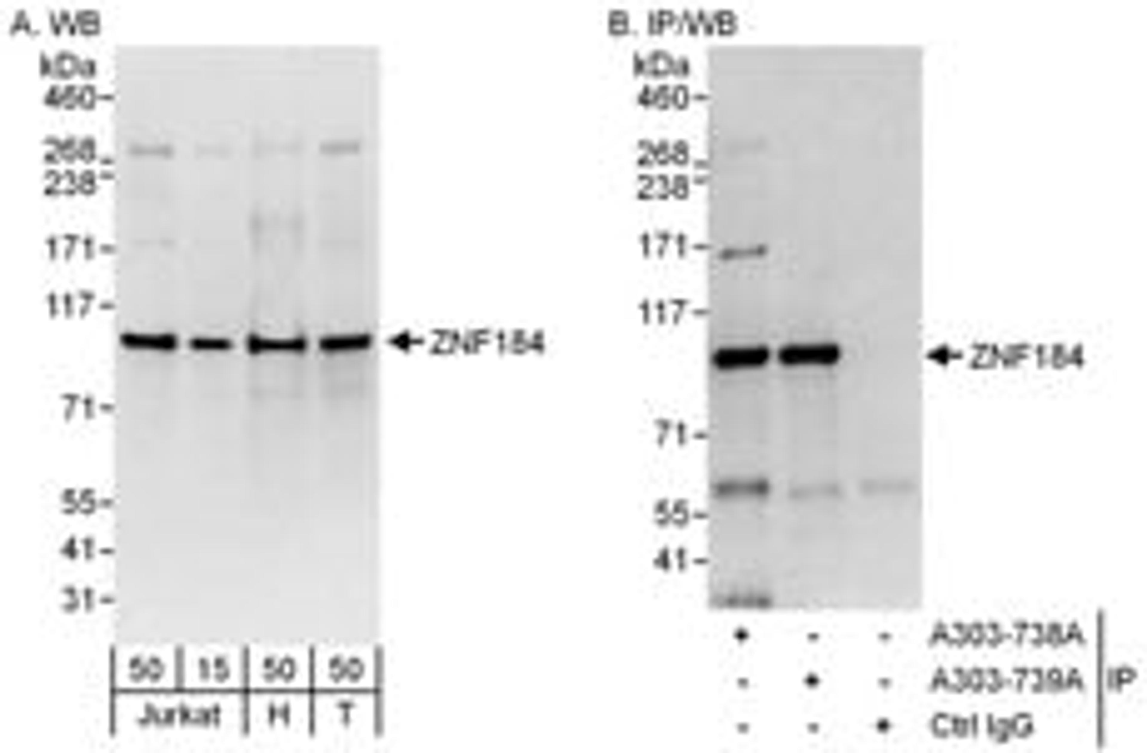 Detection of human ZNF184 by western blot and immunoprecipitation.