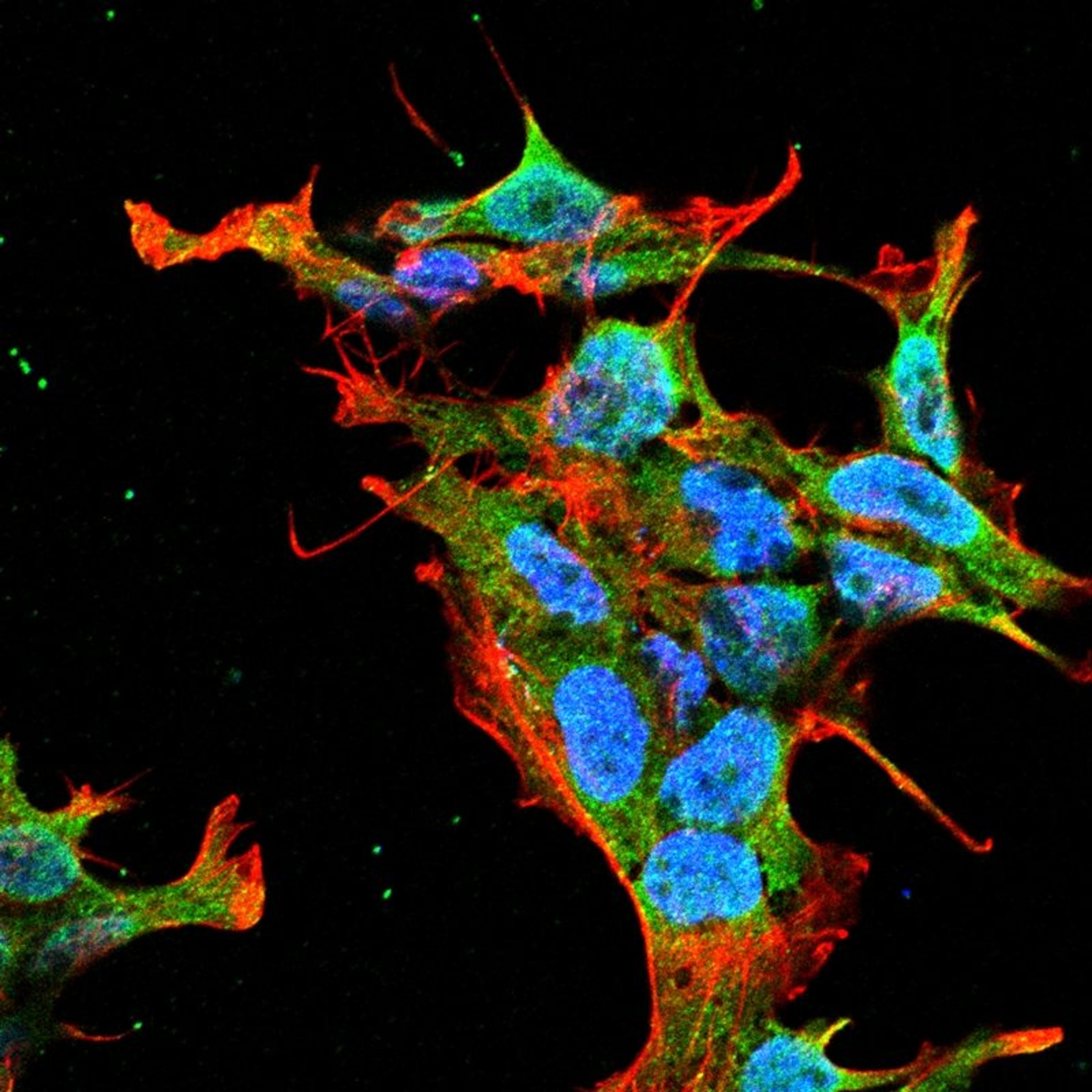 Immunofluorescence analysis of neuroblastoma cell line sk-n-be using Kv3.2 antibody